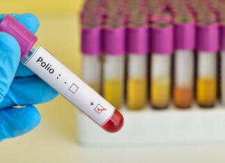 CDC Issues Polio Warning For International Travelers — Where The Virus Is Circulating