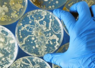Deadly fungal illnesses linked to Medical tourism in Mexico